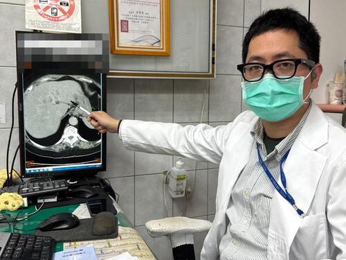 1150122婦嗜好甜食逾六成全是脂肪肝 病變釀成癌