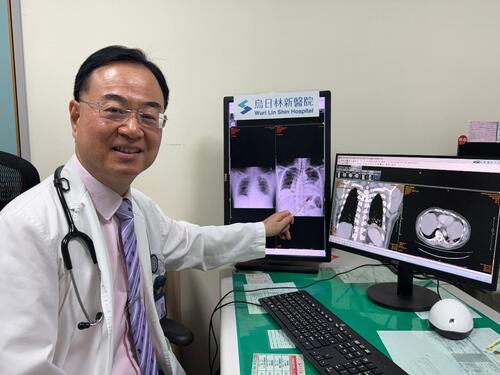 1150612口腔細菌也會侵肺！52歲男胸痛就醫1天半惡化成罕見膿胸 微小微單胞菌作怪 歷經肋膜腔插管引流並手術清創痊癒產品圖