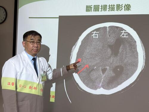 1150615忙到半邊無力！攤商端節前「亞急性腦出血」 醫籲3徵兆快就醫產品圖