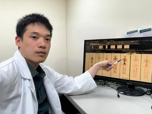 1150819癌細胞轉移骨頭痛到睡不著！ 精準「鐳」擊帶攝護腺癌患者減痛又延命 骨轉移不再只能靠止痛藥　醫：核醫治療帶來新希望產品圖