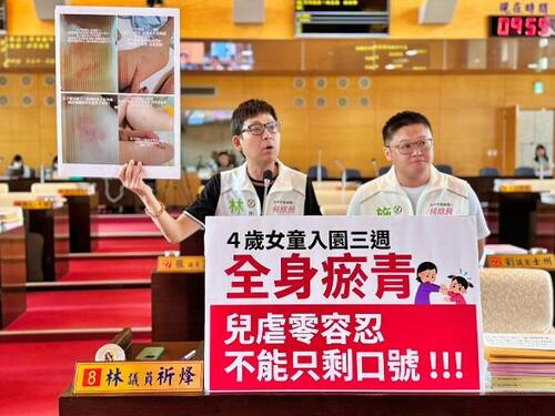 1150820四歲女童入園三週全身瘀青 議員林祈烽怒批中市府縱容四天 教育局：掌握相關佐證展開調查產品圖